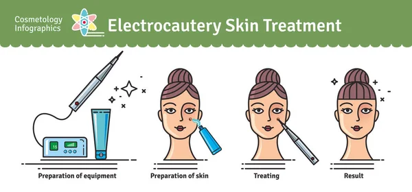 Vector Ilustrado con cosmetología electrocauterio tratamiento de la piel — Vector de stock