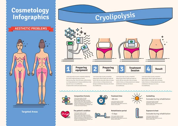 Vektor illustriertes Set mit kosmetologischer Kryolipolyse-Behandlung — Stockvektor