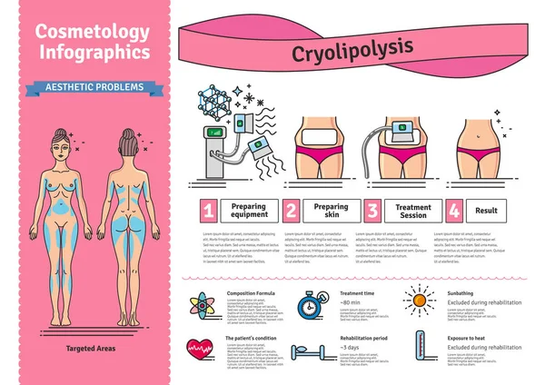 Set illustrato vettoriale con trattamento cosmetologico Cryolipolysis — Vettoriale Stock