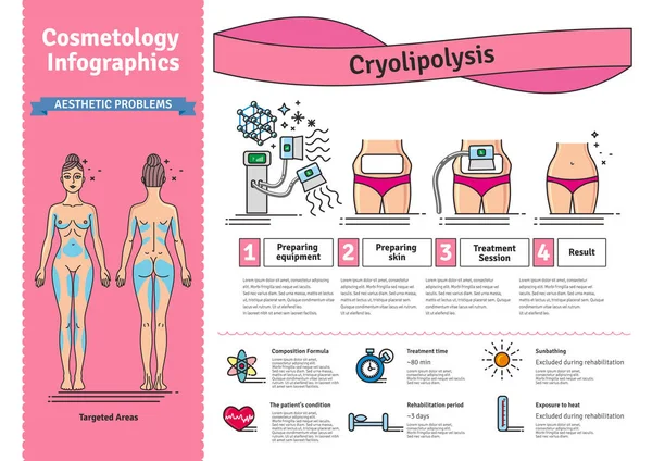 Vector Conjunto ilustrado con cosmetología Tratamiento de criolipólisis — Archivo Imágenes Vectoriales