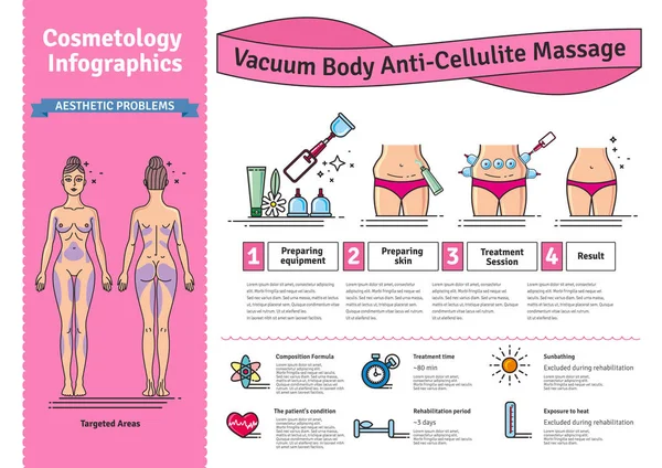 Vektör Illustrated salon vakum vücut Anti-Selülit Masajı ile ayarla — Stok Vektör