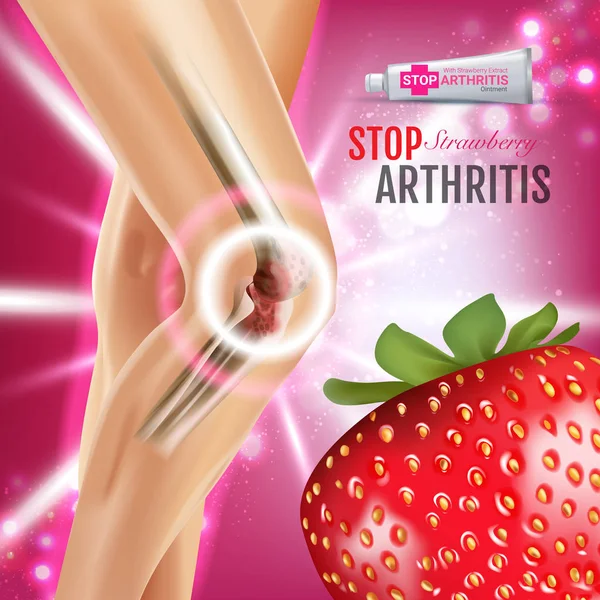 Arthritis Pain Relief Ointment ads. Vector 3d Illustration with Tube cream with strawberry extract. — Stock Vector