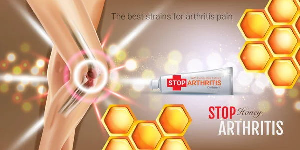 Artritis pijn verlichting zalf advertenties. Vector 3d illustratie met buis crème met honing extract. — Stockvector