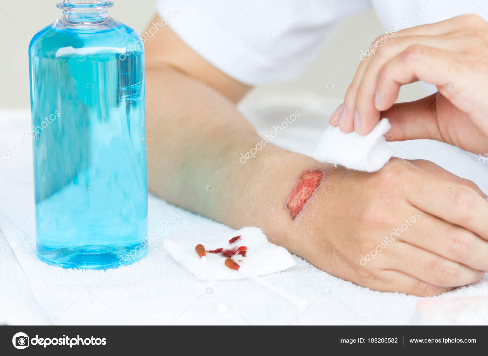 Man cleaning lesion or wound on his arm with alcohol Stock Photo by