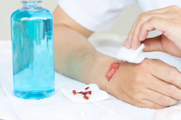 Adam temizlik lezyon ya da alkol ile kolundaki yara