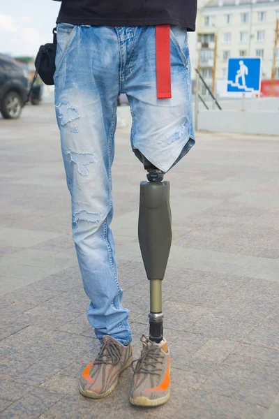 Amputado masculino con una pierna protésica —  Fotos de Stock