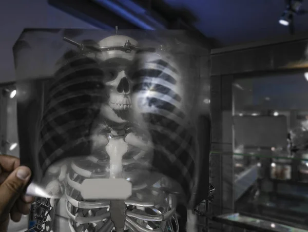 skull and neck  at x-ray film viewer on the left , hand holding model of skull bones. skeleton model.