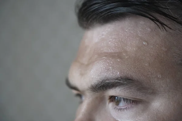 Forehead Sweat Face Very Sweating Man Hot Summertime Season — Stock Photo, Image