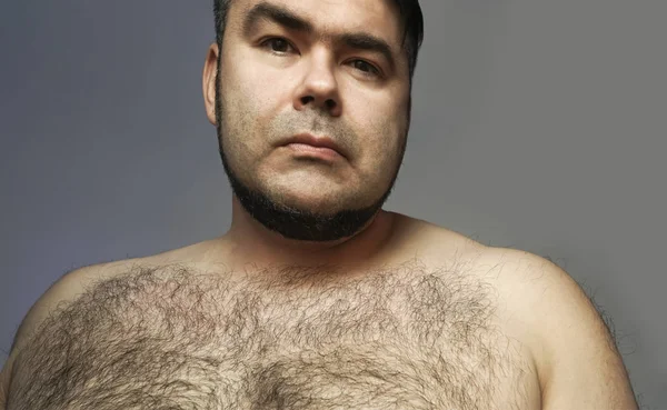 Närbild Porträtt Hårig Man Hårig Kropp Man Bröstet Överdriven Hårväxt — Stockfoto