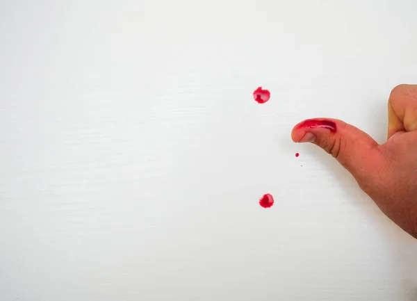 Krwawiący Kciuk Bliska Szkocka Palec Kciuk Kroplą Świeżej Krwi — Zdjęcie stockowe