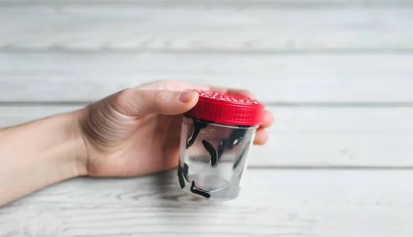 Leeches in a small jar.Self-medication.