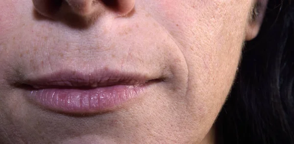 Detail van gerimpelde lippen van een middelbare leeftijd vrouw, 40-45 jaar — Stockfoto