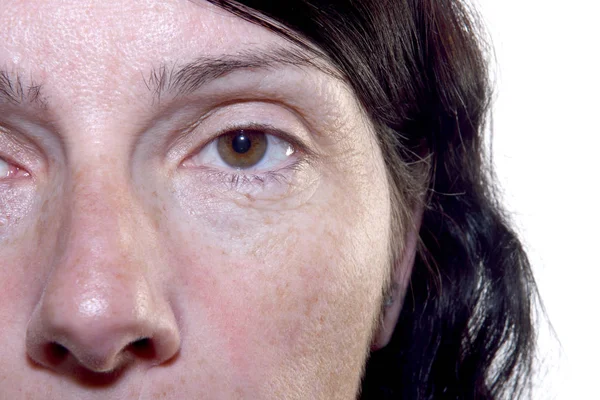 Wrinkles in the eyes of a middle-aged woman 40-45 years