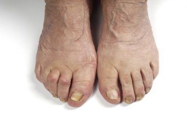 Beyaz bir kadın kıdemli başlangıç