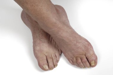 Beyaz bir kadın kıdemli başlangıç