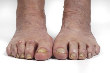 Beyaz bir kadın kıdemli başlangıç