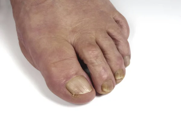 Donna anziano piede su bianco — Foto Stock