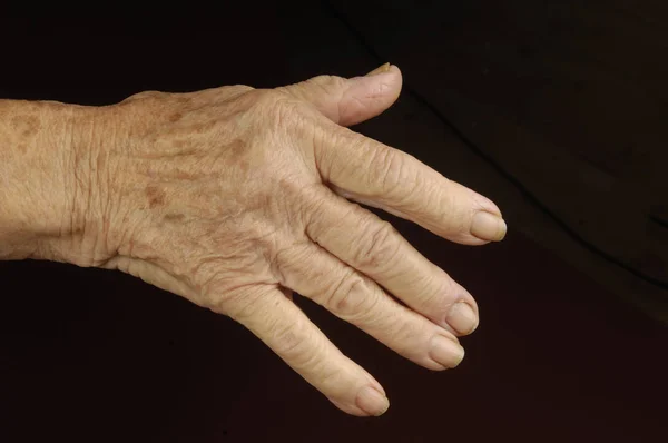 Yaşlı kadının elleri siyah — Stok fotoğraf