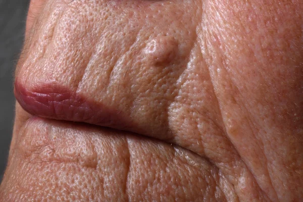 Primer plano de una arrugas alrededor de los labios —  Fotos de Stock