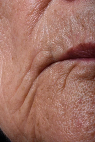 Närbild av en rynkor runt läpparna — Stockfoto