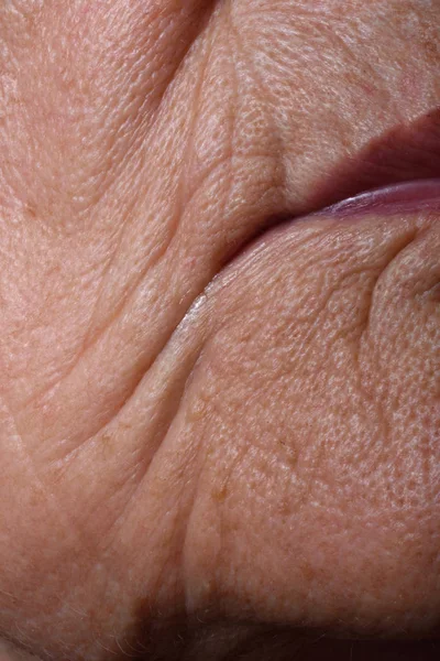 Wrinkles around the lips — Stock Photo, Image