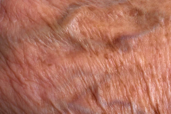 Textura e manchas nas mãos enrugadas de uma mulher idosa — Fotografia de Stock