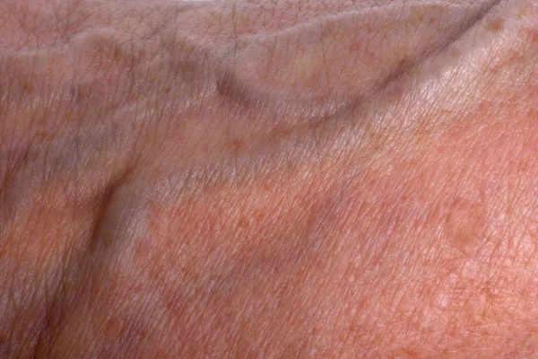 Textura e manchas nas mãos enrugadas de uma mulher idosa — Fotografia de Stock
