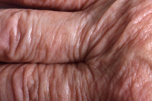 Yaşlı bir kadının el parmakları deri dokusuna,