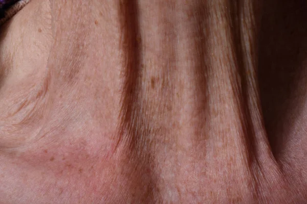 Wrinkles on the neck of an elderly woman — Stock Photo, Image