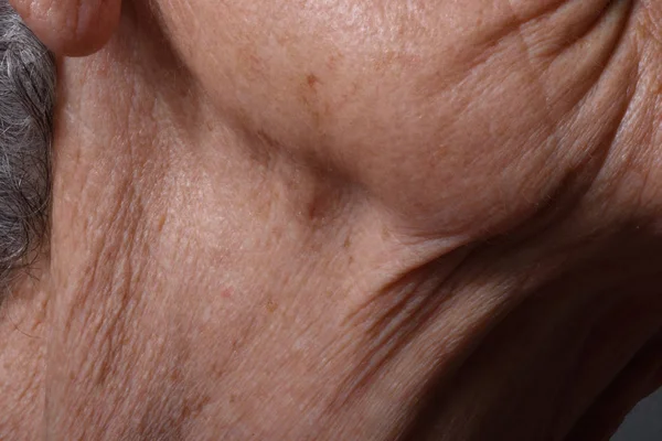 Arrugas en la barbilla y el cuello de una mujer mayor — Foto de Stock