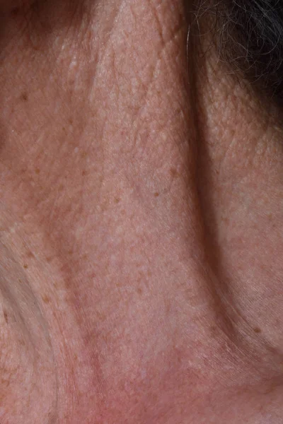 Arrugas en el cuello de una anciana — Foto de Stock