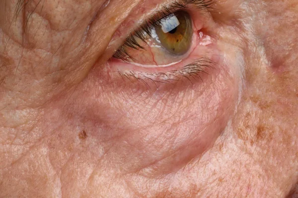 Sacos nos olhos de uma mulher mais velha — Fotografia de Stock