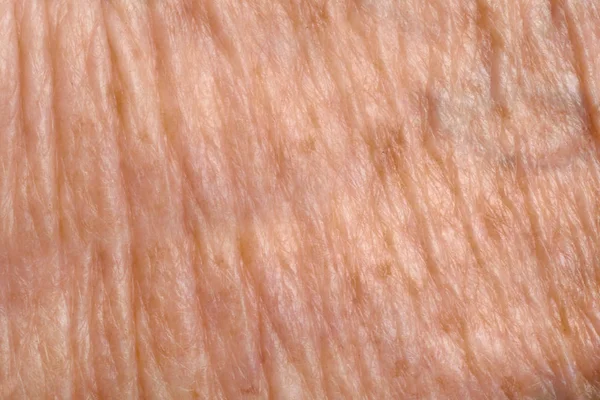 Detalhe da pele textura, mulher sênior, braço — Fotografia de Stock