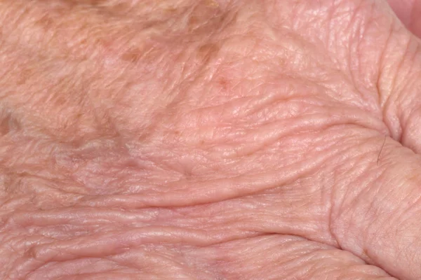 Detalhe da pele de textura de uma mulher sênior, mão e dedos , — Fotografia de Stock