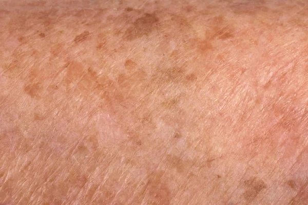 Detalhe da pele textura mulher sênior — Fotografia de Stock