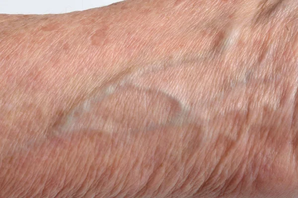 Detail of texture skin, senior woman,arm