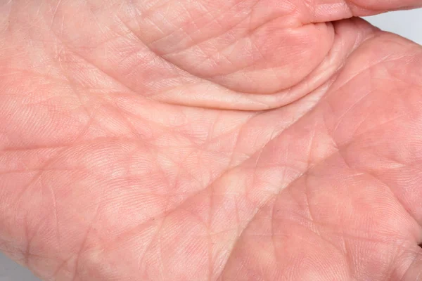 Szczegół tekstura skóry starszy Kobieta, ręka — Zdjęcie stockowe