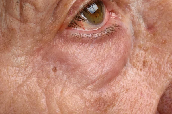 Мешки в глазах пожилой женщины — стоковое фото