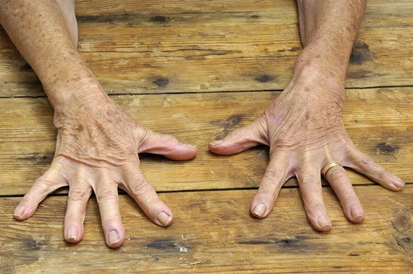 Hände der Seniorin auf Holz-Hintergrund — Stockfoto