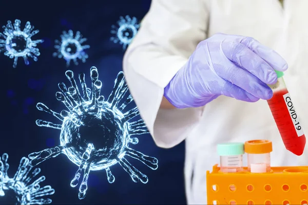 연구소에서 코로나 바이러스에 생물학적 튜브를 미생물학자 Covid 레이블 — 스톡 사진