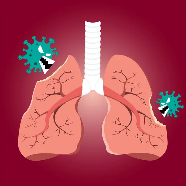 Dañado Por Células Virales Que Muerden Los Pulmones Coronavirus Covid — Vector de stock