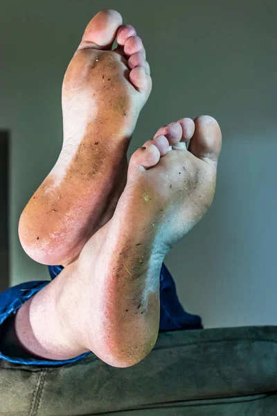 vertical feet dirty sole on crossed and relaxing on sofa