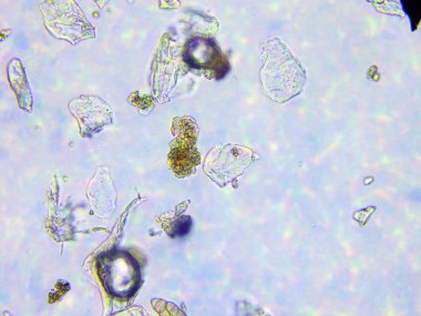 Toz ve mikroorganizmaların mikroskobik görünümü