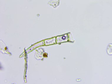 Toz ve mikroorganizmaların mikroskobik görünümü