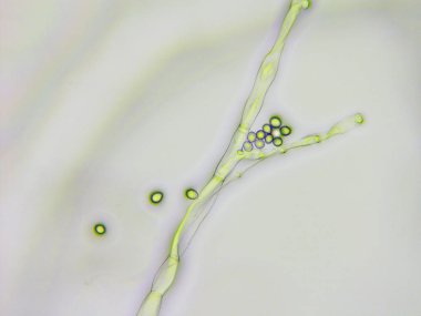 Kalıp mikroskobik görünümü, arkadan aydınlatmalı tekniği