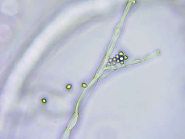 Kalıp mikroskobik görünümü, arkadan aydınlatmalı tekniği