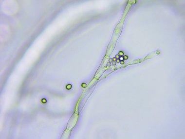 Kalıp mikroskobik görünümü, arkadan aydınlatmalı tekniği