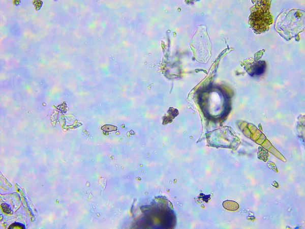 Микроскопический обзор пыли и микроорганизмов — стоковое фото