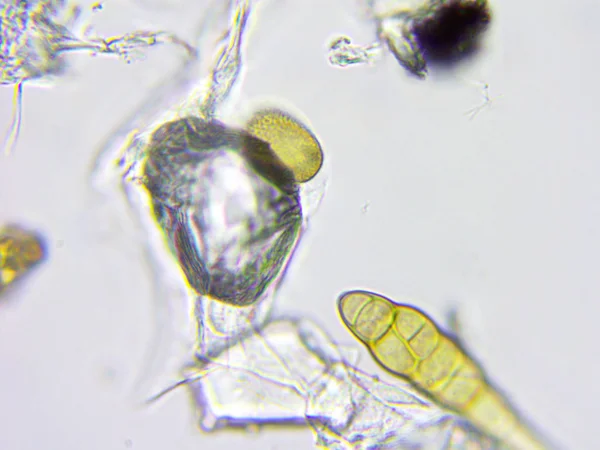 Toz ve mikroorganizmaların mikroskobik görünümü — Stok fotoğraf
