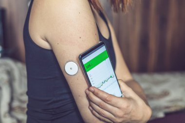 Glikoz seviyesini modern teknoloji uzaktan kumandalı sensör ve cep telefonuyla kan olmadan kontrol eden bir kadın. Diyabet tedavisi.